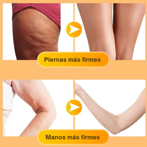 Celulitis Oil Samara™
