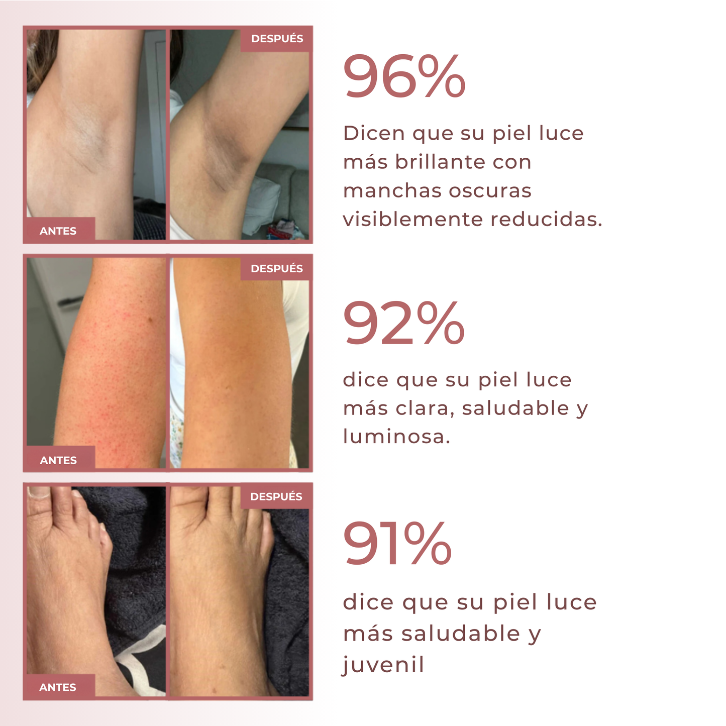 Spray exfoliante corporal - Kójico + Cúrcuma